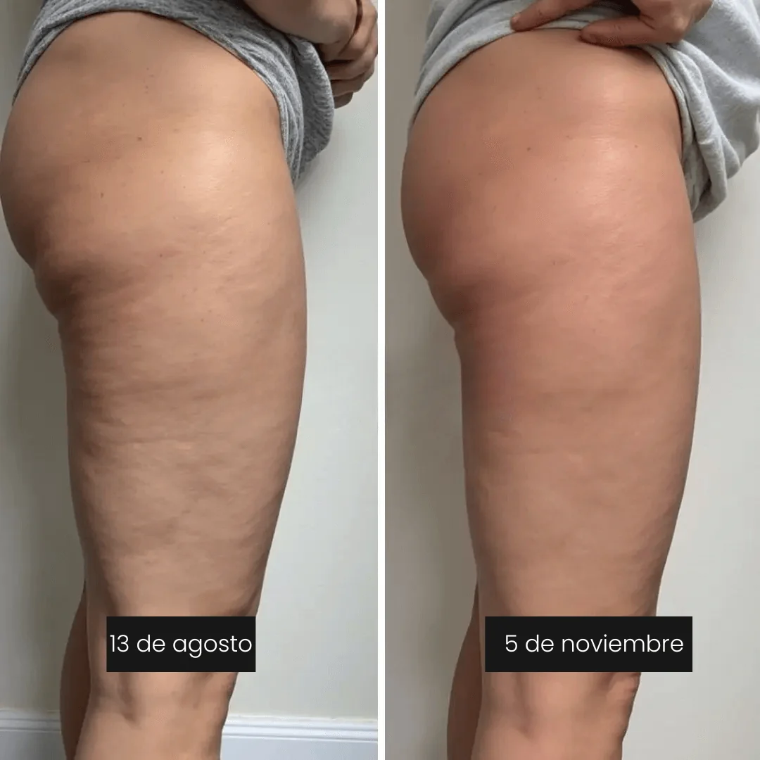 cellufit pantalon